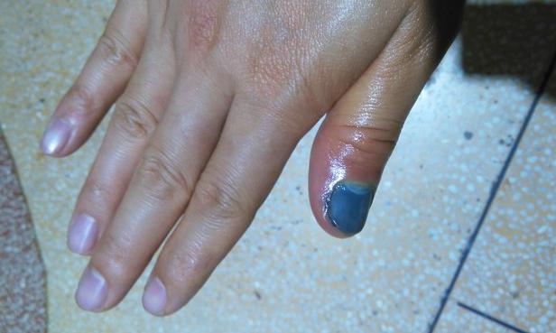 小时候的调皮后果,小时候调皮捣蛋的经历