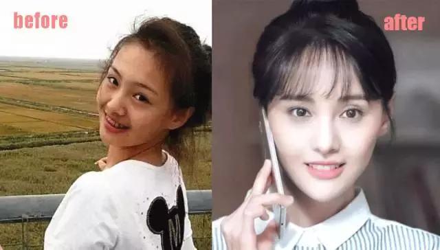 整牙=整容？看杨幂、刘涛、高圆圆为你亲身示范！