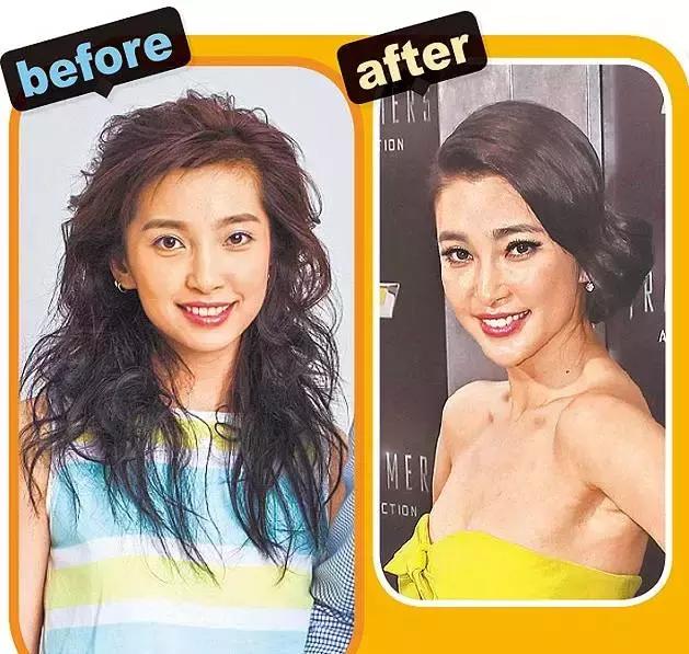 整牙=整容？看杨幂、刘涛、高圆圆为你亲身示范！