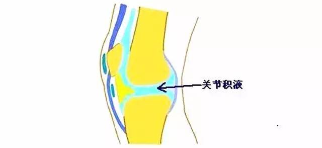滑膜炎到底怎样才能根治,滑膜炎是一种治不好的病吗