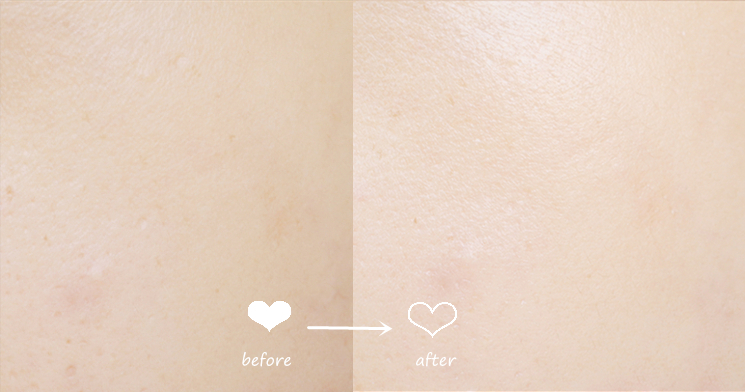 dr.wu达尔肤面膜测评,drwu达尔肤面膜适合什么肤质