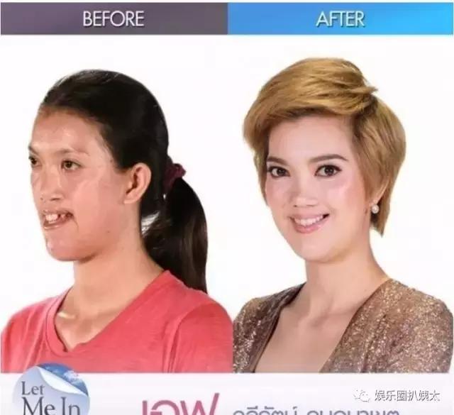 泰国专门的整容节目,泰国的整容节目有哪些