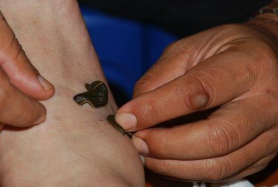 能杀死水体寄生虫的中草药,嗜血虫子