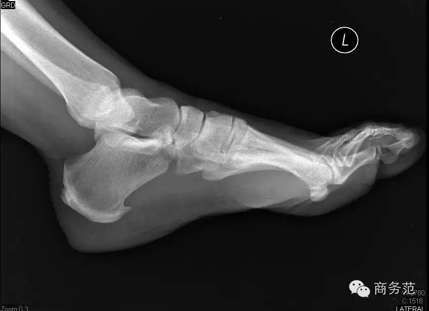 ugg值得买吗,冬天不要买太多衣服