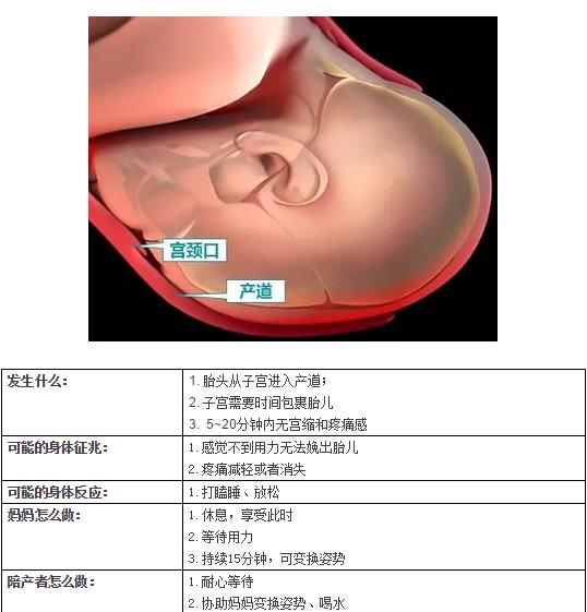 生娃就像拉便便一样？超详细的第二产程