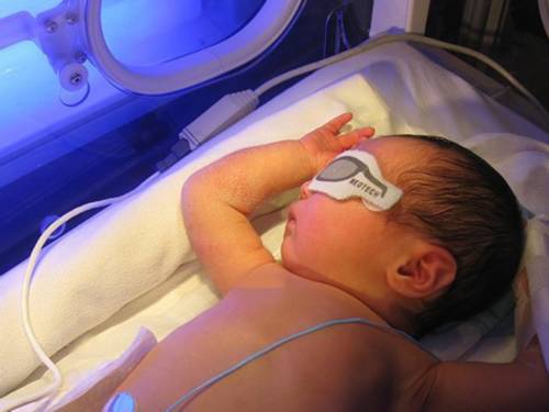 新生儿黄疸超标的症状及危害,新生儿黄疸超标怎么办