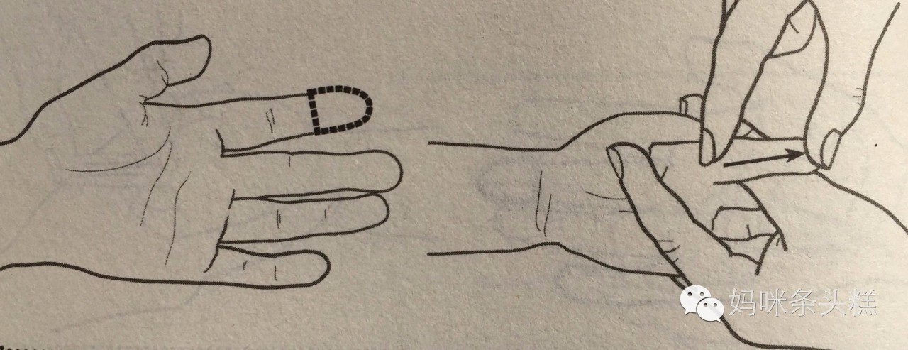 宝宝自汗和盗汗的原因及调理方案,怎么判断宝宝是盗汗还是正常出汗