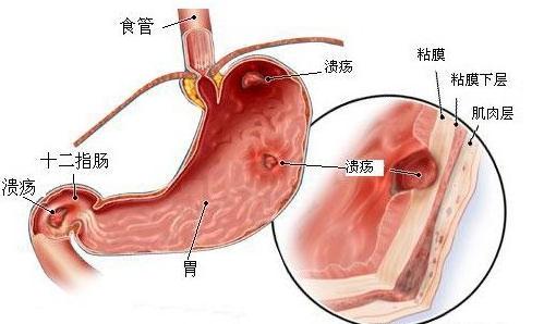 会遗传的病叫什么,会遗传的慢性病