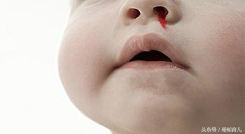 7个月流鼻血的五大原因,七月龄宝宝流鼻血怎么回事