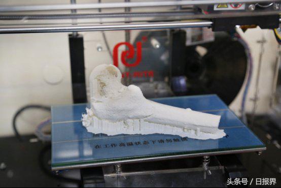 天威耗材3D技术助力珠海骨科精准医疗