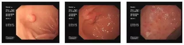 舌苔辨证图谱望舌识病,揭秘舌苔图谱轻松自诊