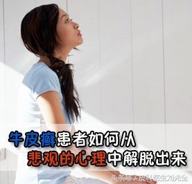 银屑病患者适合生二胎吗,孕妇长银屑藓要怎么处理