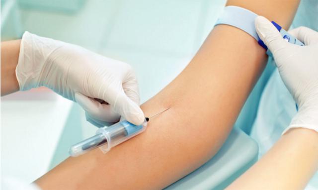 割双眼皮需要问医生哪些问题,割双眼皮会不会很痛呢