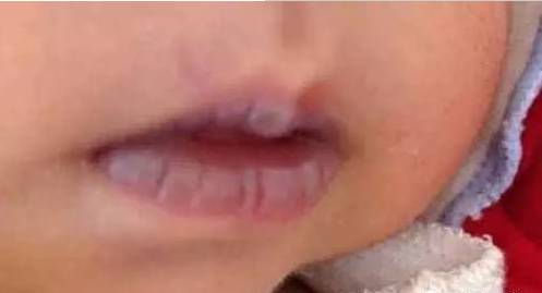 一旦嘴唇变成这种颜色就要警惕,嘴唇发黄要警惕这是一种常见疾病