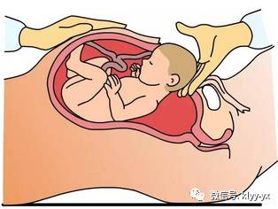 「分娩前后」想要顺产？看完这个就放心了！