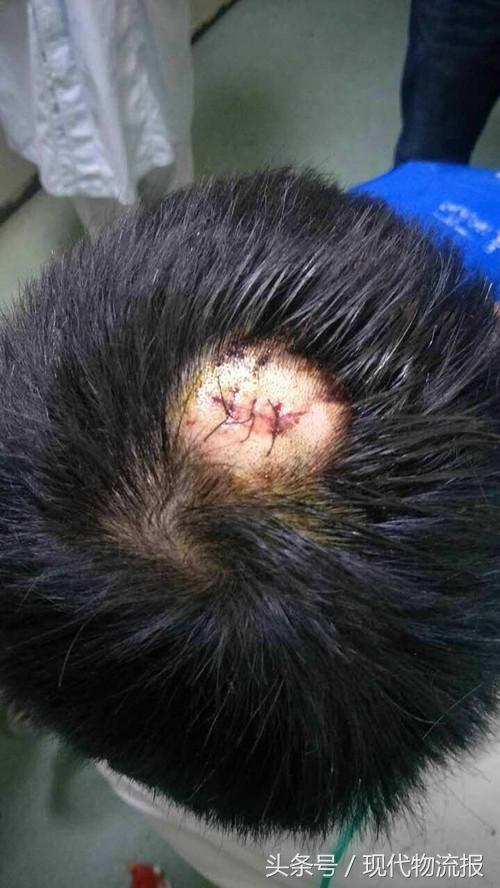 好又快收加盟费后不开网？加盟商讨说法遭毒打致伤