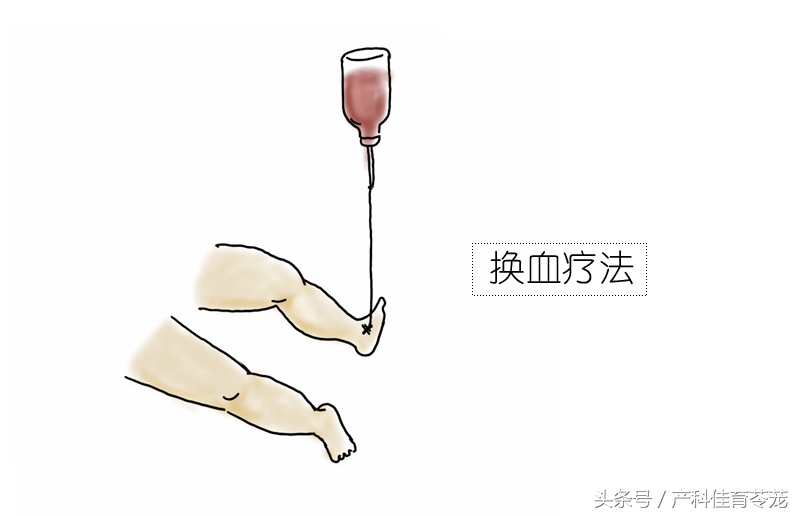 突然发现宝宝皮肤黄,宝宝皮肤黄原来是这些原因导致的