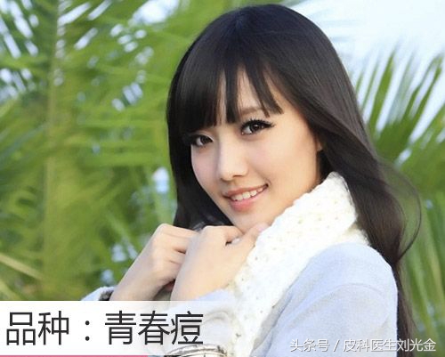 青春痘原因中医观点,后背长青春痘什么原因