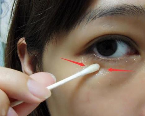 眼袋对形象影响有多大?看看你就都知道了!