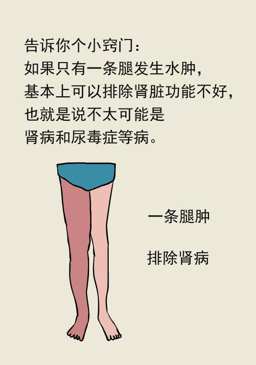 单腿肿和双腿肿的区别,两条腿肿的程度不一样