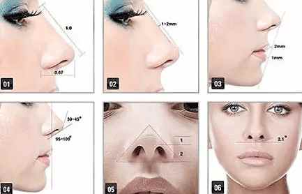 韩式隆鼻因为“韩式”价格翻番,汇总你都踩过多少坑?