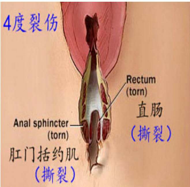 女子警报器响起,女生拉响警报器