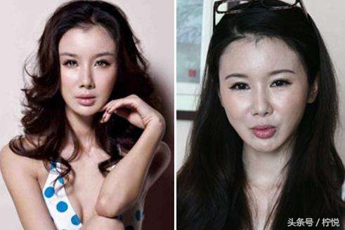 超声刀美容真的有效果吗,超声刀美容保持的时间