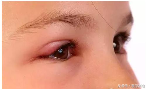 新冠红眼病有什么症状,羔羊红眼病的症状及治疗