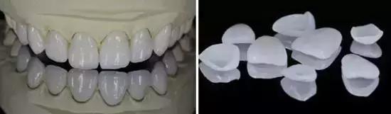 牙齿美白的必备干货,真正靠谱的牙齿美白方法