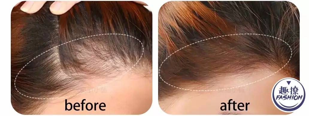 拯救进口小哥迪玛希，我想要他的同款高发际线！