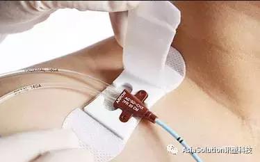 医疗器械英语说明书,医疗器械相关中英术语库