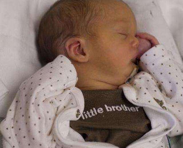 一个小孩一出生就长着猪鼻子,刚出生的婴儿猪鼻子