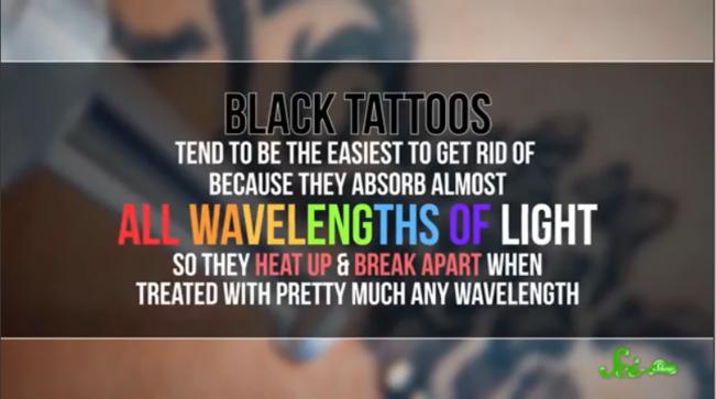 现在怎么去除纹身,怎么才可以去除纹身
