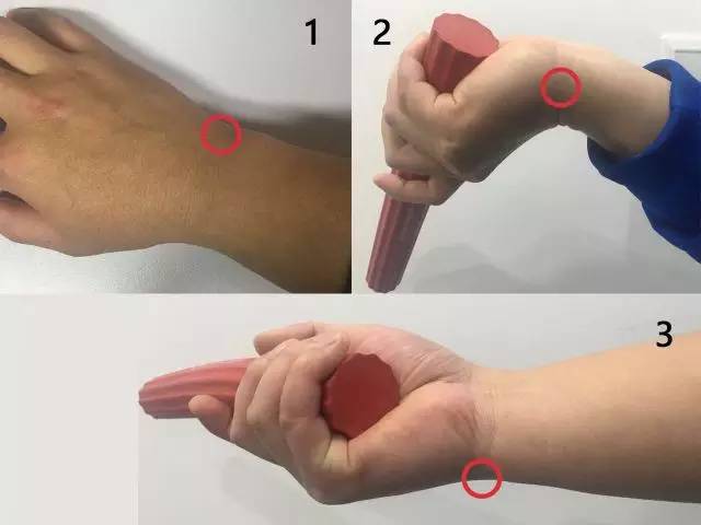 答疑(14):肿胀的滑膜容易再次受伤