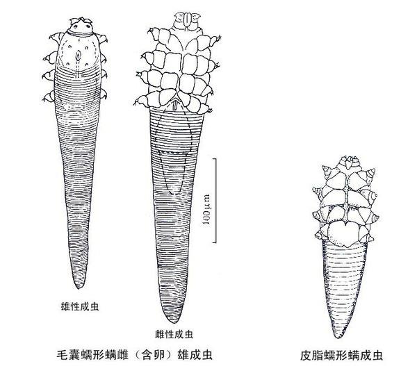 黑头粉刺也是虫吗,挤黑头粉刺毛孔里面像虫一样很长