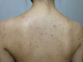 女性气血不足身上有什么症状,女性三大症状引起重视