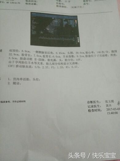 孕妇产检小孩入盆是快生了吗,宫口开了一指胎儿是不是入盆了