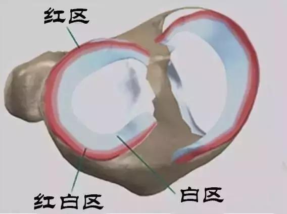 膝关节嘎吱作响半月板损伤,膝关节半月板损伤弹响怎么办