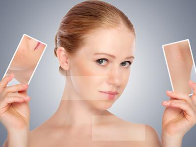 小孩最快解决痘痘的方法,长痘痘的小伙伴们看过来