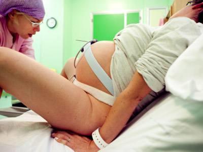 顺产侧切对夫妻有什么影响,顺产侧切对夫妻影响有多大