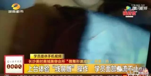 微整形乱象的解决对策,非法行医微整形纠纷