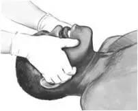 足球倒地急救,足球比赛昏厥怎么处理