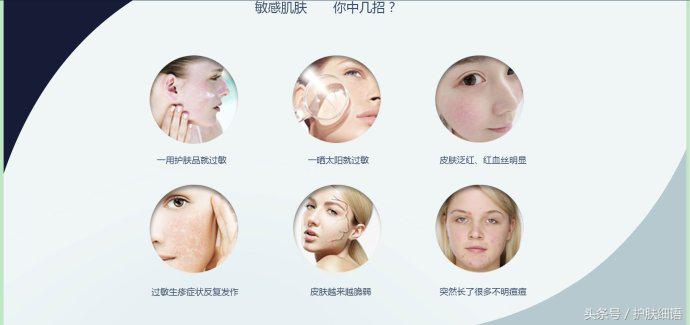 喝酒过敏了最简单的处理方法,有效快速治疗过敏的方法