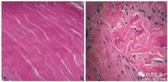 初跑者跑完脚痛怎么办,跑者小腿疼痛如何解决