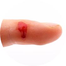 怎样避免诱发和加重银屑病的因素？——苏飞医生讲堂实录