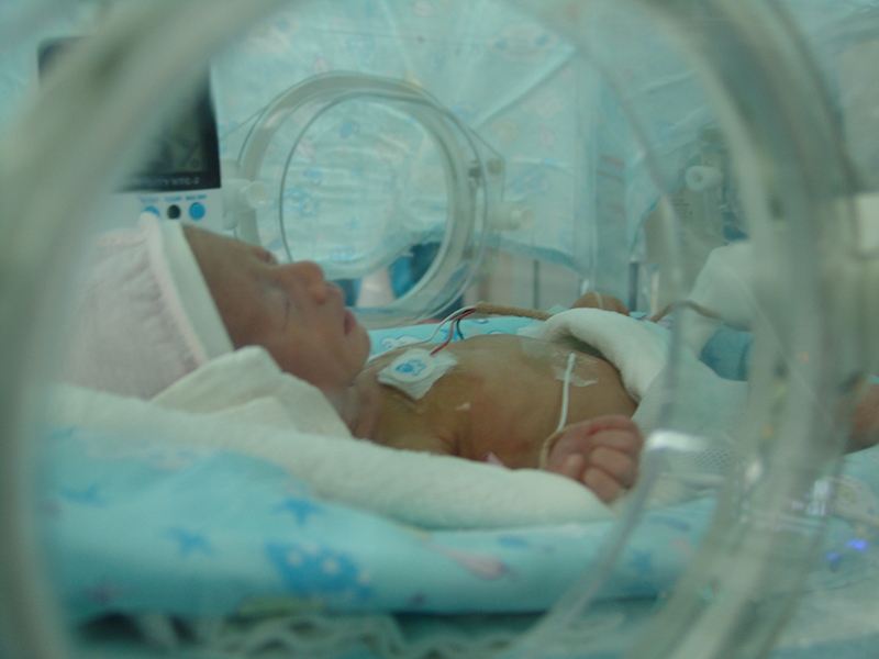 早产婴儿甲减治疗,早产儿先天性甲减要长期吃药吗