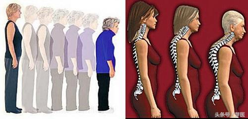 人的器官衰老的时间表,决定身体衰老速度的原因
