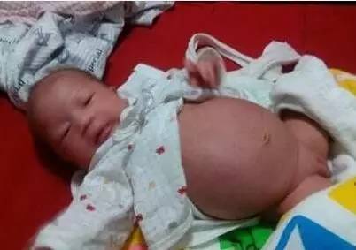 25天的宝宝8个小时没拉粑粑怎么办,我家宝宝8天没有拉粑粑了怎么办