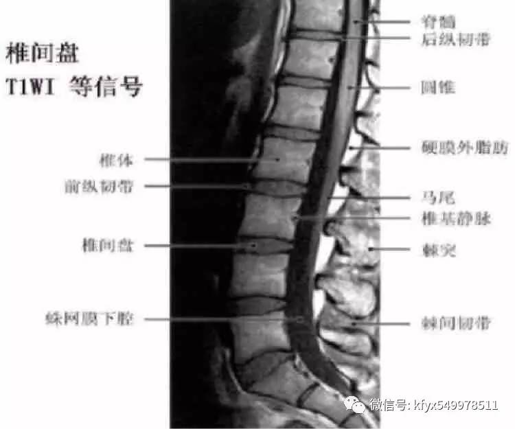 教你如何看腰椎磁共振