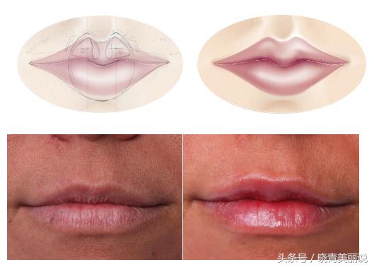 李小璐吐槽大会说贾乃亮,李小璐丰唇